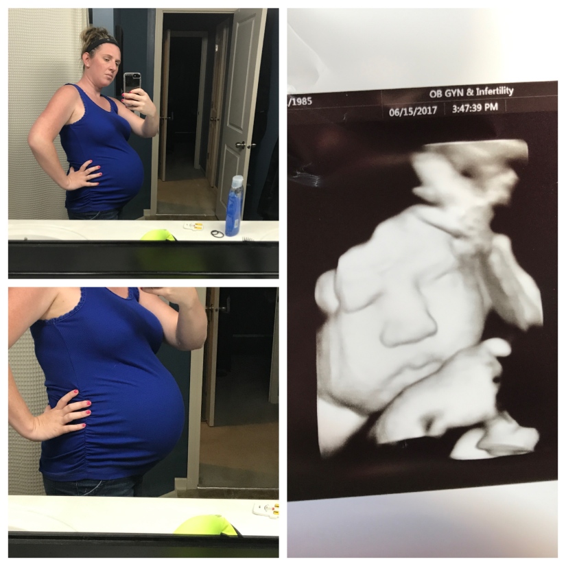 baby bump 3 26 weeks